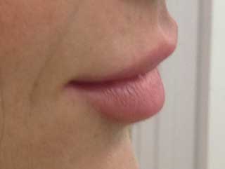 lips after